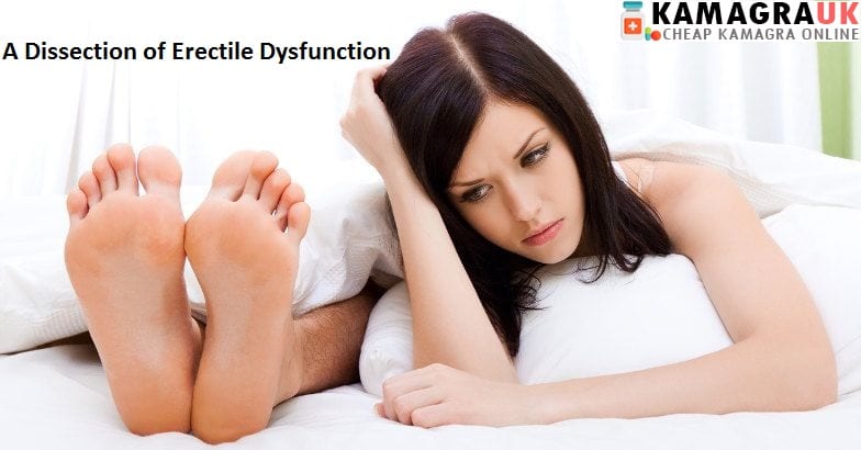 A Dissection of Erectile Dysfunction
